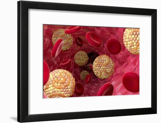 High Cholesterol Levels, Artwork-David Mack-Framed Photographic Print