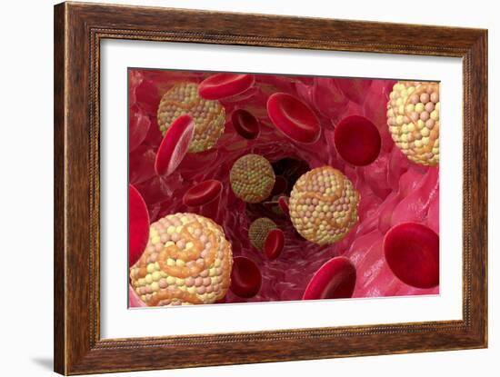 High Cholesterol Levels, Artwork-David Mack-Framed Photographic Print