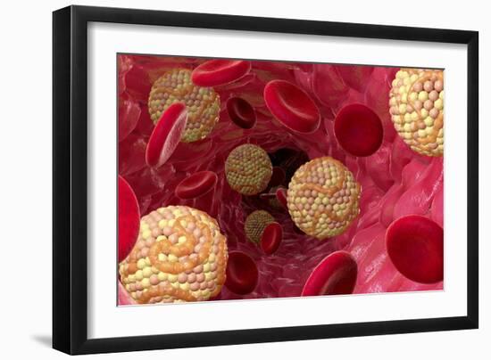 High Cholesterol Levels, Artwork-David Mack-Framed Photographic Print