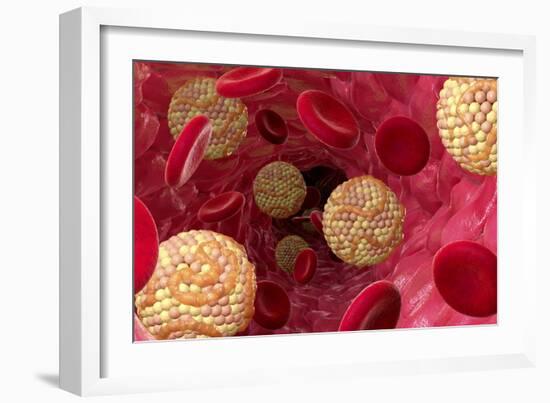 High Cholesterol Levels, Artwork-David Mack-Framed Photographic Print