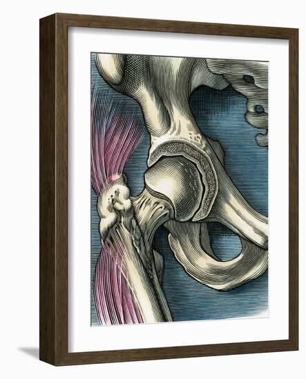 Hip Joint, Artwork-Bill Sanderson-Framed Photographic Print