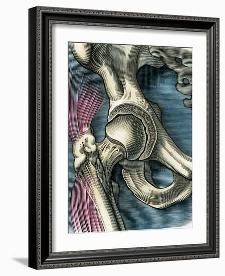 Hip Joint, Artwork-Bill Sanderson-Framed Photographic Print