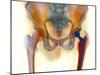 Hip Joint Replacement, X-ray-Science Photo Library-Mounted Photographic Print