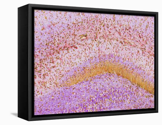 Hippocampus Brain Tissue-Thomas Deerinck-Framed Premier Image Canvas