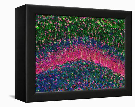 Hippocampus Brain Tissue-Thomas Deerinck-Framed Premier Image Canvas