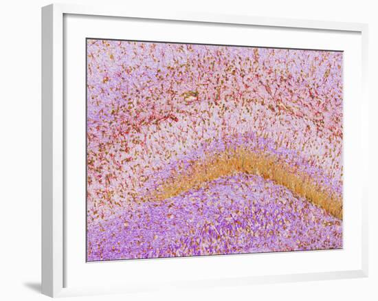 Hippocampus Brain Tissue-Thomas Deerinck-Framed Photographic Print