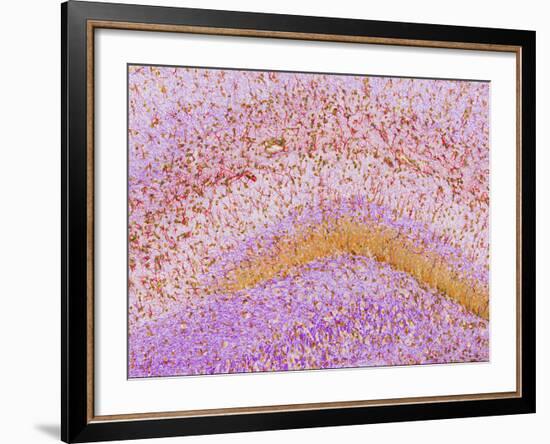 Hippocampus Brain Tissue-Thomas Deerinck-Framed Photographic Print