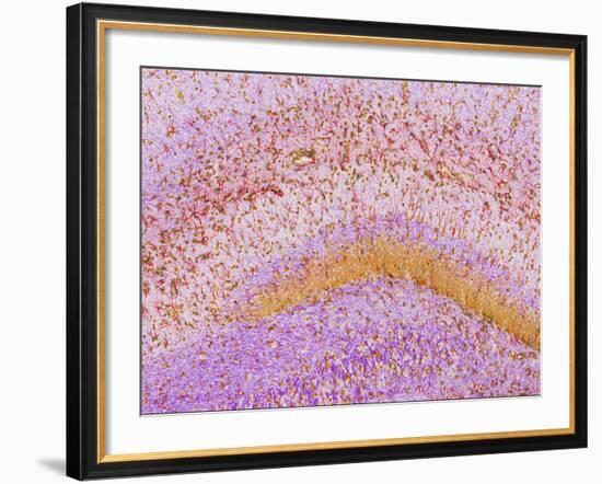 Hippocampus Brain Tissue-Thomas Deerinck-Framed Photographic Print