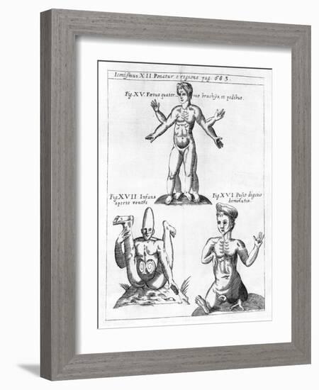 Historical Birth Deformities-Science, Industry and Business Library-Framed Photographic Print