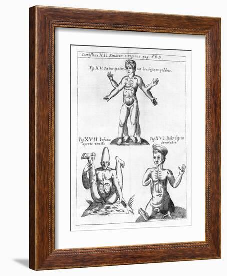 Historical Birth Deformities-Science, Industry and Business Library-Framed Photographic Print