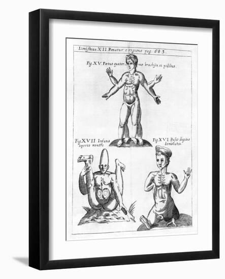 Historical Birth Deformities-Science, Industry and Business Library-Framed Photographic Print