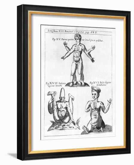 Historical Birth Deformities-Science, Industry and Business Library-Framed Photographic Print