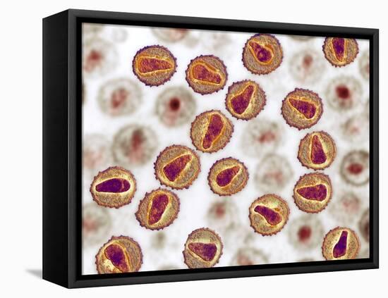 HIV Particles, TEM-Ami Images-Framed Premier Image Canvas