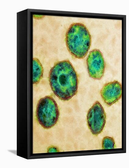 HIV Particles, TEM-Science Photo Library-Framed Premier Image Canvas