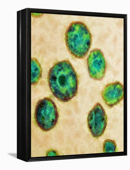 HIV Particles, TEM-Science Photo Library-Framed Premier Image Canvas
