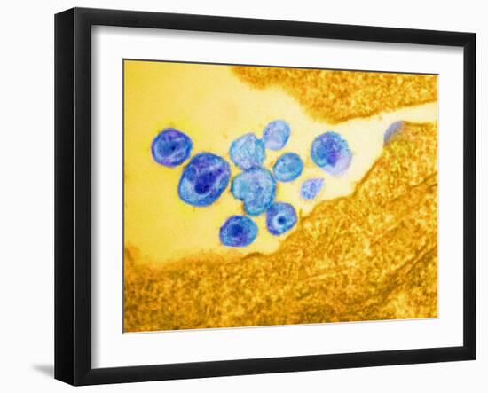 HIV Particles, TEM-Science Photo Library-Framed Photographic Print