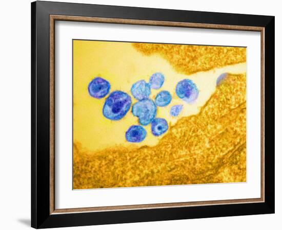 HIV Particles, TEM-Science Photo Library-Framed Photographic Print