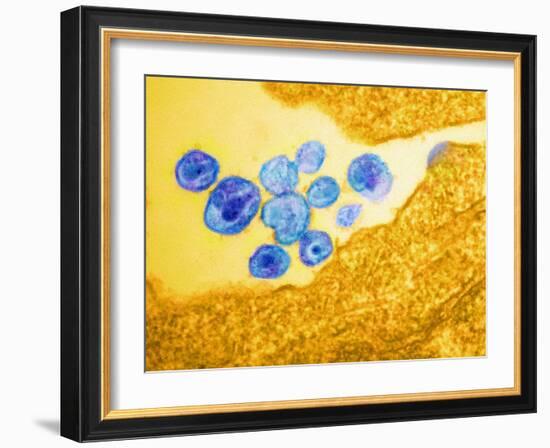 HIV Particles, TEM-Science Photo Library-Framed Photographic Print