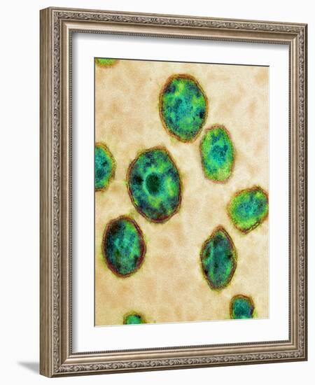 HIV Particles, TEM-Science Photo Library-Framed Photographic Print
