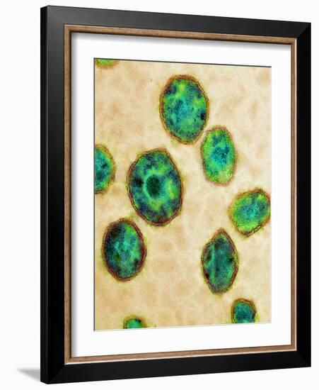 HIV Particles, TEM-Science Photo Library-Framed Photographic Print