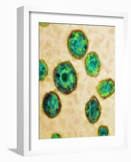 HIV Particles, TEM-Science Photo Library-Framed Photographic Print