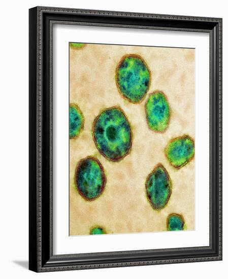 HIV Particles, TEM-Science Photo Library-Framed Photographic Print