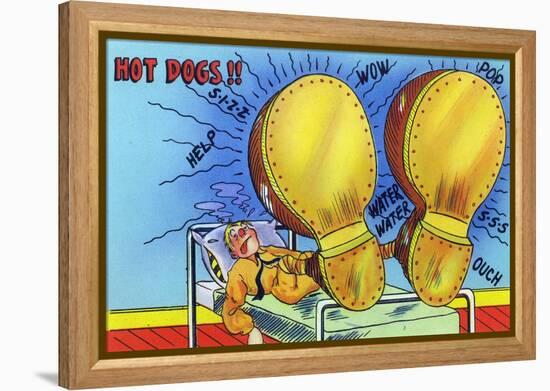 Hot Dogs, Soldier with Sore, Enlarged Feet-Lantern Press-Framed Stretched Canvas