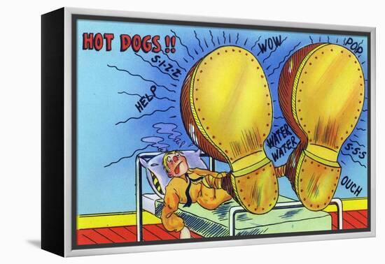 Hot Dogs, Soldier with Sore, Enlarged Feet-Lantern Press-Framed Stretched Canvas