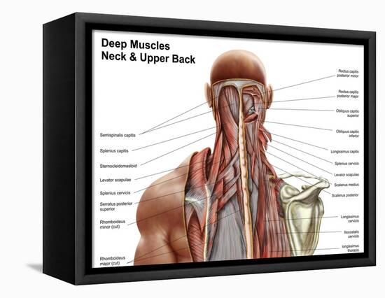 Human Anatomy Showing Deep Muscles in the Neck and Upper Back-null-Framed Stretched Canvas