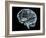 Human Brain, Artwork-Laguna Design-Framed Photographic Print