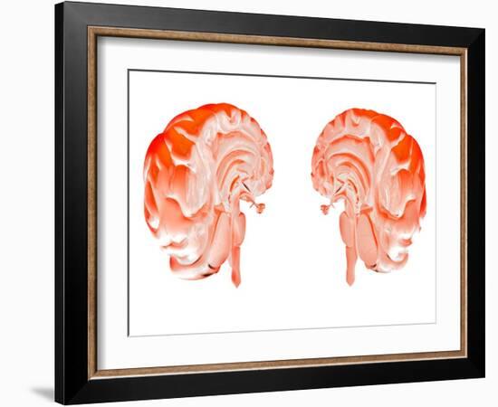 Human Brain, Artwork-Victor Habbick-Framed Photographic Print