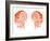 Human Brain, Artwork-Victor Habbick-Framed Photographic Print