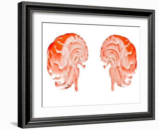 Human Brain, Artwork-Victor Habbick-Framed Photographic Print