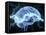 Human Brain, Conceptual Artwork-PASIEKA-Framed Premier Image Canvas