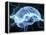 Human Brain, Conceptual Artwork-PASIEKA-Framed Premier Image Canvas