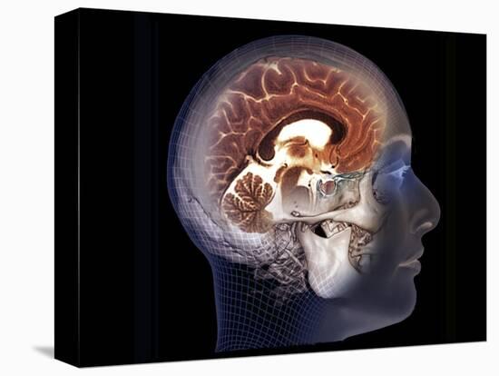 Stretched Canvas Print, , large