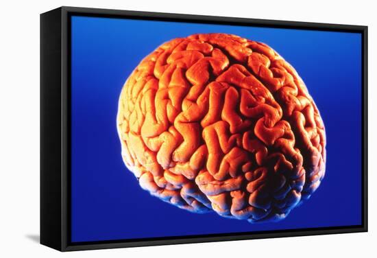 Human Brain-Volker Steger-Framed Premier Image Canvas