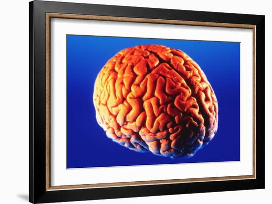 Human Brain-Volker Steger-Framed Photographic Print