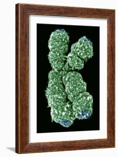 Human Chromosome 10, SEM-Science Photo Library-Framed Photographic Print