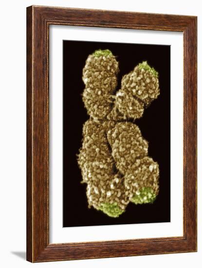 Human Chromosome 10, SEM-Science Photo Library-Framed Photographic Print