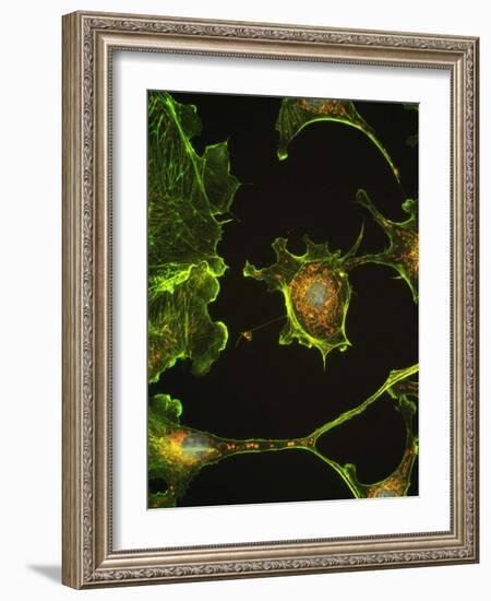 Human Epithelial Cells-Riccardo Cassiani-ingoni-Framed Photographic Print