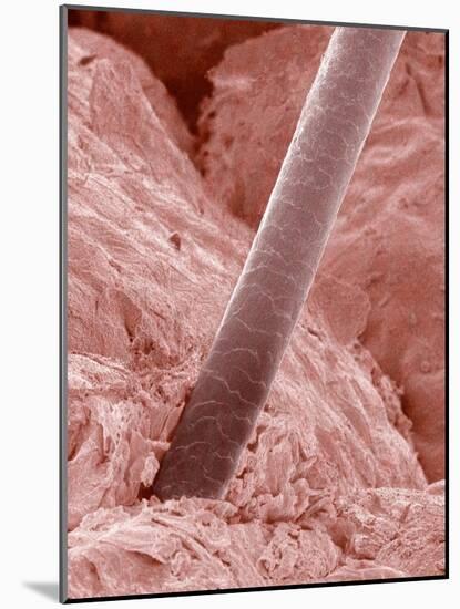 Human Hair and Skin-Micro Discovery-Mounted Photographic Print
