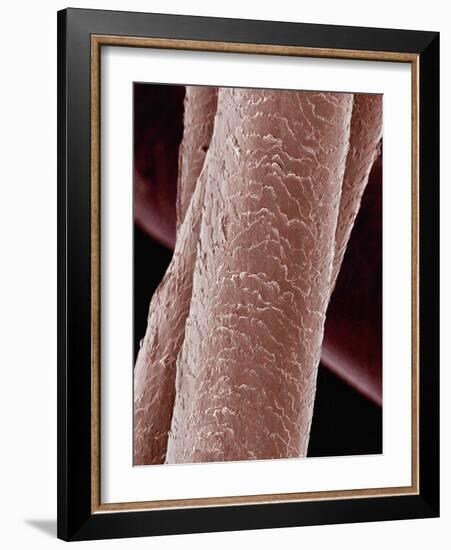 Human Hair-Micro Discovery-Framed Photographic Print