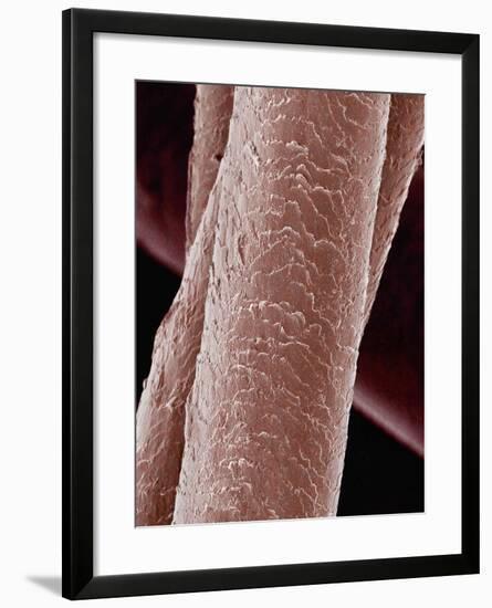 Human Hair-Micro Discovery-Framed Photographic Print