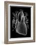 Human Heart, Anatomical Artwork-PASIEKA-Framed Photographic Print