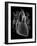 Human Heart, Anatomical Artwork-PASIEKA-Framed Photographic Print