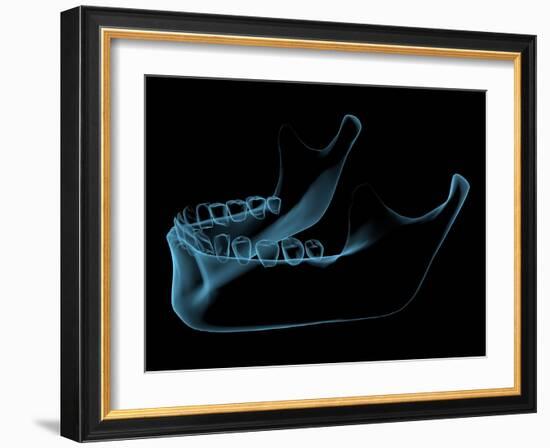 Human Jaw-sauliusl-Framed Art Print