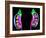 Human Kidneys, Artwork-Roger Harris-Framed Photographic Print