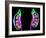 Human Kidneys, Artwork-Roger Harris-Framed Photographic Print