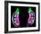 Human Kidneys, Artwork-Roger Harris-Framed Photographic Print